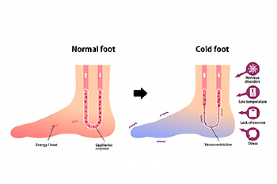6 reasons why your feet are always cold in winter and what to do